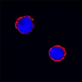 Fc gamma RII/RIII (CD32/CD16) was detected in immersion fixed mouse splenocytes using Goat Anti-Mouse Fc gamma RII/RIII (CD32/CD16) Antigen Affinity-purified Polyclonal Antibody (Catalog # AF1460) at 15 µg/mL for 3 hours at room temperature. Cells were stained using the NorthernLights™ 557-conjugated Anti-Goat IgG Secondary Antibody (red; Catalog # NL001) and counterstained with DAPI (blue). Specific staining was localized to cytoplasm. View our protocol for Fluorescent ICC Staining of Non-adherent Cells.