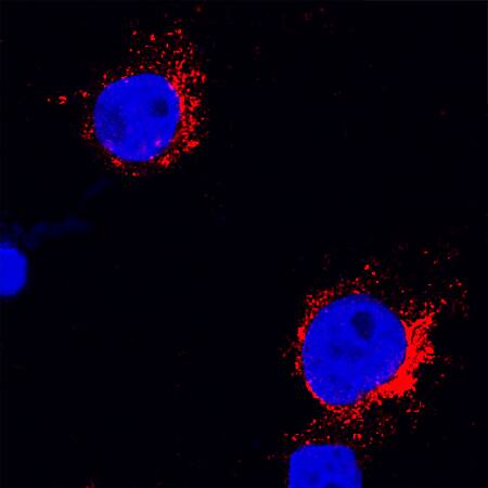 Immunocytochemistry Fc gamma RI/CD64 Antibody (10.1) [Unconjugated]