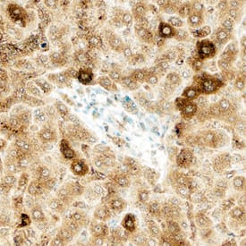 Fer was detected in immersion fixed paraffin-embedded sections of human liver using Mouse Anti-Human Fer Monoclonal Antibody (Catalog # MAB7229) at 15 µg/mL overnight at 4 °C. Before incubation with the primary antibody, tissue was subjected to heat-induced epitope retrieval using Antigen Retrieval Reagent-Basic (Catalog # CTS013). Tissue was stained using the Anti-Mouse HRP-DAB Cell & Tissue Staining Kit (brown; Catalog # CTS002) and counter-stained with hematoxylin (blue). Specific staining was localized to cytoplasm in hepatocytes. View our protocol for Chromogenic IHC Staining of Paraffin-embedded Tissue Sections.