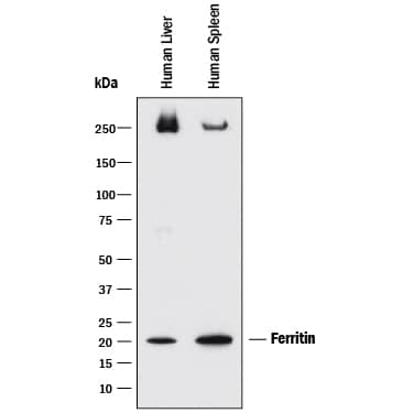 Western blot shows lysates of human liver tissue and human spleen tissue. PVDF membrane was probed with 5 µg/mL of Mouse Anti-Human Ferritin Monoclonal Antibody (Catalog # MAB93541) followed by HRP-conjugated Anti-Mouse IgG Secondary Antibody (Catalog # HAF018). A specific band was detected for Ferritin at approximately 20 kDa (as indicated). This experiment was conducted under reducing conditions and using Immunoblot Buffer Group 1.