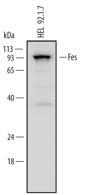 Western blot shows lysates of HEL 92.1.7 human erythroleukemic cell line. PVDF Membrane was probed with 2 µg/mL of Goat Anti-Human Fes Antigen Affinity-purified Polyclonal Antibody (Catalog # AF6460) followed by HRP-conjugated Anti-Goat IgG Secondary Antibody (Catalog # HAF109). A specific band was detected for Fes at approximately 93 kDa (as indicated). This experiment was conducted under reducing conditions and using Immunoblot Buffer Group 1.
