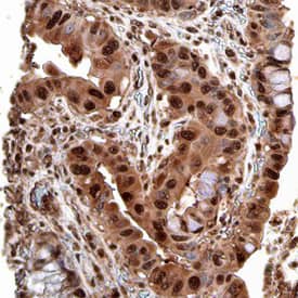 Immunohistochemistry Fes Antibody (678527)