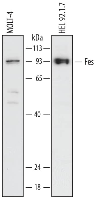 Western Blot Fes Antibody (678527)