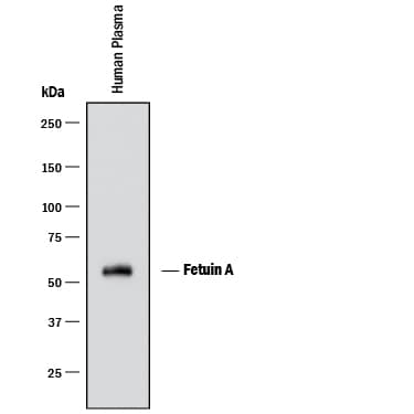 Western blot shows human plasma. PVDF membrane was probed with 0.1 µg/mL of Goat Anti-Human Fetuin A/AHSG Antigen Affinity-purified Polyclonal Antibody (Catalog # AF1184) followed by HRP-conjugated Anti-Goat IgG Secondary Antibody (Catalog # HAF017). A specific band was detected for Fetuin A/AHSG at approximately 55 kDa (as indicated). This experiment was conducted under reducing conditions and using Immunoblot Buffer Group 1.