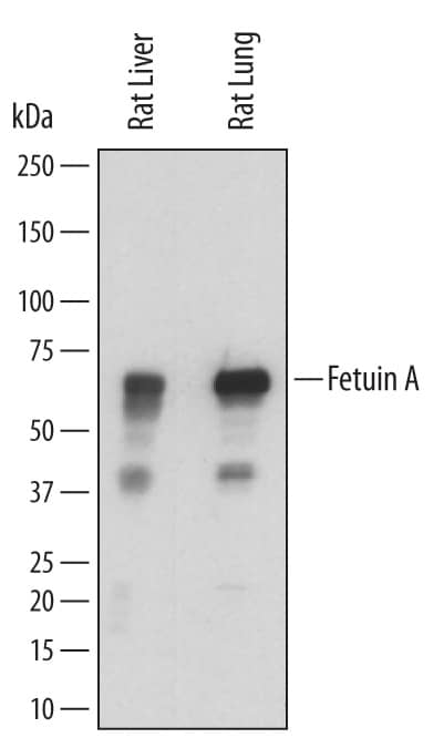 Western blot shows lysates of rat liver tissue and rat lung tissue. PVDF membrane was probed with 0.2 µg/mL of Sheep Anti-Rat Fetuin A/AHSG Antigen Affinity-purified Polyclonal Antibody (Catalog # AF7510) followed by HRP-conjugated Anti-Sheep IgG Secondary Antibody (Catalog # HAF016). A specific band was detected for Fetuin A/AHSG at approximately 59-64 kDa (as indicated). This experiment was conducted under reducing conditions and using Immunoblot Buffer Group 1.