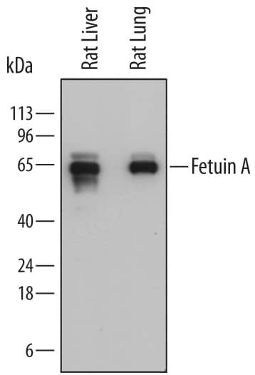 Western blot shows lysates of rat liver tissue and rat lung tissue. PVDF membrane was probed with 0.2 µg/mL of Mouse Anti-Rat Fetuin A/AHSG Monoclonal Antibody (Catalog # MAB7510) followed by HRP-conjugated Anti-Mouse IgG Secondary Antibody (Catalog # HAF018). A specific band was detected for Fetuin A/AHSG at approximately 60-65 kDa (as indicated). This experiment was conducted under reducing conditions and using Immunoblot Buffer Group 1.