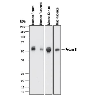 Western Blot Fetuin B Antibody [Unconjugated]