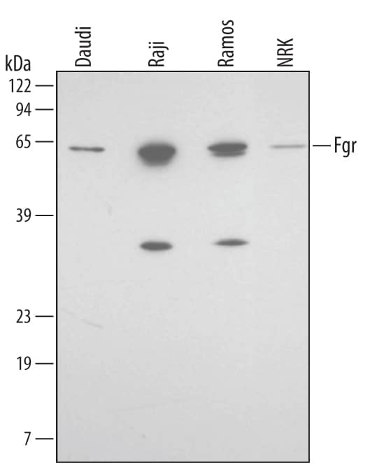 Western blot shows lysates of Daudi human Burkitt's lymphoma cell line, Raji human Burkitt's lymphoma cell line, Ramos human Burkitt's lymphoma cell line, and NRK rat normal kidney cell line. PVDF membrane was probed with 0.2 µg/mL of Human/Mouse/Rat Fgr Monoclonal Antibody (Catalog # MAB3207) followed by HRP-conjugated Anti-Mouse IgG Secondary Antibody (Catalog # HAF007). A specific band was detected for Fgr at approximately 59 kDa (as indicated). This experiment was conducted under reducing conditions and using Immunoblot Buffer Group 3.