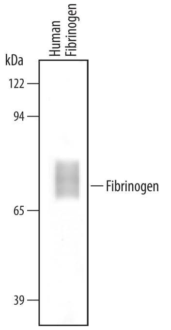 Western Blot Fibrinogen Antibody [Unconjugated]