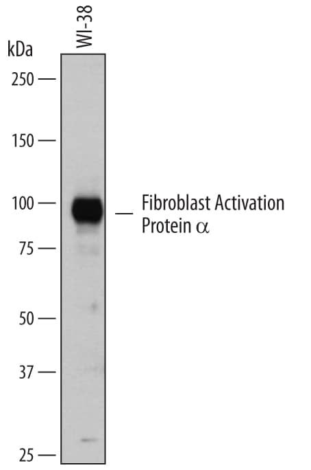 Western Blot Fibroblast Activation Protein alpha/FAP Antibody [Unconjugated]