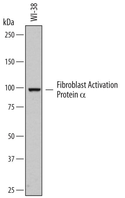 Western blot shows lysates of WI-38 human lung fibroblast cell line. PVDF membrane was probed with 0.5 µg/mL of Sheep Anti-Human Fibroblast Activation Protein a/FAP Biotinylated Antigen Affinity-purified Polyclonal Antibody (Catalog # BAF3715) followed by Streptavidin-HRP (Catalog # DY998). A specific band was detected for Fibroblast Activation Protein a/FAP at approximately 97 kDa (as indicated). This experiment was conducted under reducing conditions and using Immunoblot Buffer Group 1.