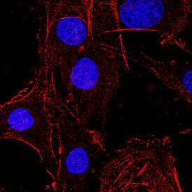 Fibroblast Activation Protein a/FAP was detected in immersion fixed C2C12 mouse myoblast cell line using Rat Anti-Mouse Fibroblast Activation Protein a/FAP Monoclonal Antibody (Catalog # MAB9727) at 8 µg/mL for 3 hours at room temperature. Cells were stained using the NorthernLights™ 557-conjugated Anti-Rat IgG Secondary Antibody (red; Catalog # NL013) and counterstained with DAPI (blue). Specific staining was localized to plasma membrane and cytoplasm. View our protocol for Fluorescent ICC Staining of Cells on Coverslips.