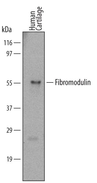 Western Blot Fibromodulin/FMOD Antibody (549302)