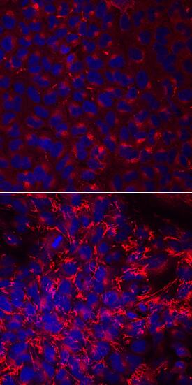 <b>Biological Strategies Validation. </b>Fibronectin was detected in immersion fixed A549 human lung carcinoma cell line untreated (top panel) or treated with 10 ng/mL TGF-beta (Catalog # 240-B, lower panel) for 48 hours using Sheep Anti-Human/Rat Fibronectin Antigen Affinity-purified Polyclonal Antibody (Catalog # AF1918) at 10 µg/mL for 3 hours at room temperature. Cells were stained using the NorthernLights™ 557-conjugated Anti-Sheep IgG Secondary Antibody (red; Catalog # NL010) and counterstained with DAPI (blue). View our protocol for Fluorescent ICC Staining of Cells on Coverslips.