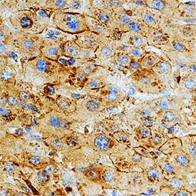 Fibronectin was detected in immersion fixed paraffin-embedded sections of human liver using Sheep Anti-Human/Rat Fibronectin Antigen Affinity-purified Polyclonal Antibody (Catalog # AF1918) at 10 µg/mL overnight at 4 °C. Tissue was stained using the Anti-Sheep HRP-DAB Cell & Tissue Staining Kit (brown; Catalog # CTS019) and counterstained with hematoxylin (blue). Specific staining was localized to plasma membranes in hepatocytes. View our protocol for Chromogenic IHC Staining of Paraffin-embedded Tissue Sections.