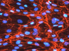 Fibronectin was detected in immersion fixed WS-1 human fetal skin fibroblast cell line using 10 µg/mL Mouse Anti-Human Fibronectin Monoclonal Antibody (Catalog # MAB19181) for 3 hours at room temperature. Cells were stained with the NorthernLights™ 557-conjugated Anti-Mouse IgG Secondary Antibody (red; Catalog # NL007) and counter-stained with DAPI (blue). View our protocol for Fluorescent ICC Staining of Cells on Coverslips.