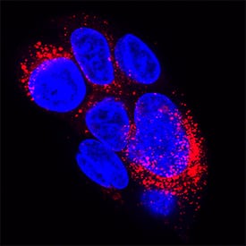 <b>Biological Strategies Validation. </b>Fibronectin was detected in immersion fixed HepG2 human hepatocellular carcinoma cell line treated with monensin using Mouse Anti-Human Fibronectin Monoclonal Antibody (Catalog # MAB19182) at 3 µg/mL for 3 hours at room temperature. Cells were stained using the NorthernLights™ 557-conjugated Anti-Mouse IgG Secondary Antibody (red; Catalog # NL007) and counterstained with DAPI (blue). Specific staining was localized to cytoplasm (punctate). View our protocol for Fluorescent ICC Staining of Cells on Coverslips.