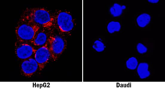 Fibronectin was detected in immersion fixed HepG2 human hepatocellular carcinoma cell line (positive staining; left panel) and Daudi human Burkitt's lymphoma cell line (negative staining; right panel) using Mouse Anti-Human Fibronectin Monoclonal Antibody (Catalog # MAB1918) at 3 µg/mL for 3 hours at room temperature. Cells were stained using the NorthernLights™ 557-conjugated Anti-Mouse IgG Secondary Antibody (red; Catalog # NL007) and counterstained with DAPI (blue). Specific staining was localized to cytoplasm. View our protocol for Fluorescent ICC Staining of Cells on Coverslips.