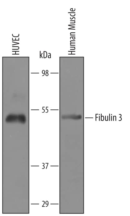 Western Blot Fibulin-3/EFEMP1 Antibody