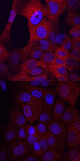 <b>Biological Strategies Validation. </b>Flt-3/Flk-2 phosphorylated at Y591 was detected in immersion fixed A431 human epithelial carcinoma cell line untreated (lower panel) or treated (upper panel) with pervanadate using Rabbit Anti-Human Phospho-Flt-3/Flk-2 (Y591) Antigen Affinity-purified Polyclonal Antibody (Catalog # AF368) at 10 µg/mL for 3 hours at room temperature. Cells were stained using the NorthernLights™ 557-conjugated Anti-Rabbit IgG Secondary Antibody (red; Catalog # NL004) and counterstained with DAPI (blue). View our protocol for Fluorescent ICC Staining of Cells on Coverslips.