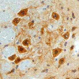 Immunohistochemistry Follistatin-like 4/FSTL4 Antibody