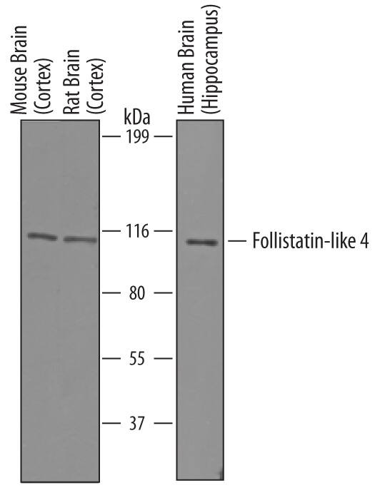 Western Blot Follistatin-like 4/FSTL4 Antibody