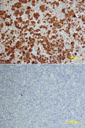 Immunohistochemistry Follistatin Antibody (85918) [Unconjugated]