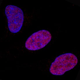 Immunocytochemistry FosB/G0S3 Antibody [Unconjugated]