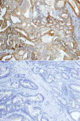 Immunohistochemistry FosB/G0S3 Antibody [Unconjugated]