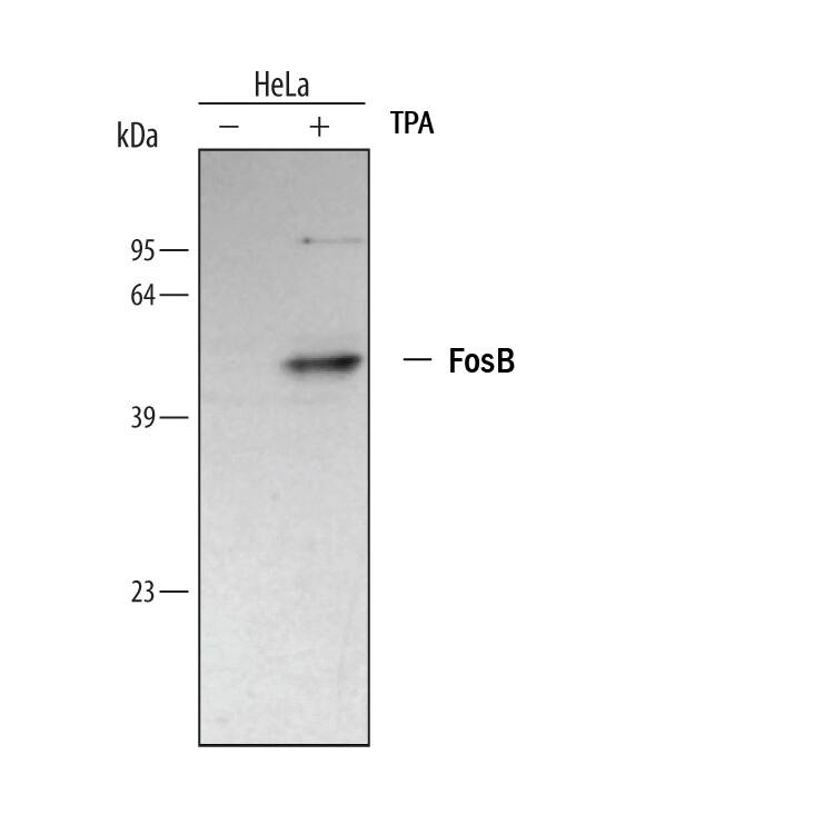 Western blot shows lysates of HeLa human cervical epithelial carcinoma cell line untreated (-) or treated (+) with TPA for 2 hours. PVDF membrane was probed with 0.5 µg/mL of Human FosB/G0S3 Monoclonal Antibody (Catalog # MAB2214), followed by HRP-conjugated Anti-Mouse IgG Secondary Antibody (HAF007). A specific band was detected for FosB/G0S3 at approximately 45 kDa (as indicated). This experiment was conducted under reducing conditions and using Immunoblot Buffer Group 1.