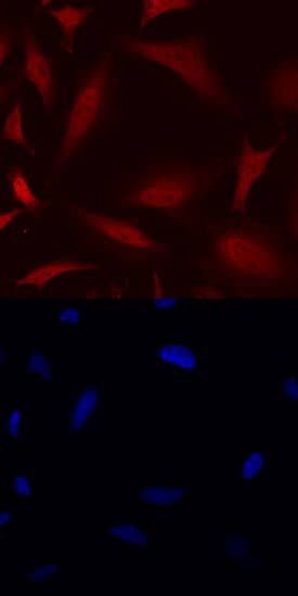 FoxC2 was detected in immersion fixed HeLa human cervical epithelial carcinoma cell line using Sheep Anti-Human FoxC2 Antigen Affinity-purified Polyclonal Antibody (Catalog # AF5044) at 10 µg/mL for 3 hours at room temperature. Cells were stained using the NorthernLights™ 557-conjugated Anti-Sheep IgG Secondary Antibody (red, upper panel; Catalog # NL010) and counterstained with DAPI (blue, lower panel). Specific staining was localized to cytoplasm and nuclei. View our protocol for Fluorescent ICC Staining of Cells on Coverslips.