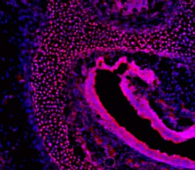 Immunohistochemistry FoxC2 Antibody