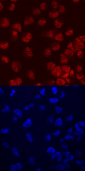 FoxC2 was detected in immersion fixed MDA-MB-453 human breast cancer cell line using Human FoxC2 Monoclonal Antibody (Catalog # MAB5044) at 10 µg/mL for 3 hours at room temperature. Cells were stained using the NorthernLights™ 557-conjugated Anti-Mouse IgG Secondary Antibody (red, upper panel; Catalog # NL007) and counterstained with DAPI (blue, lower panel). Specific staining was localized to nuclei. View our protocol for Fluorescent ICC Staining of Cells on Coverslips.