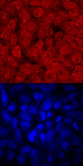 FoxD3 was detected in immersion fixed BG01V human embryonic stem cells using Sheep Anti-Human FoxD3 aa 1-140 Antigen Affinity-purified Polyclonal Antibody (Catalog # AF2819) at 10 µg/mL for 3 hours at room temperature. Cells were stained using the NorthernLights™ 557-conjugated Anti-Sheep IgG Secondary Antibody (red, upper panel; Catalog # NL010) and counterstained with DAPI (blue, lower panel). Specific staining was localized to nuclei and cytoplasm. View our protocol for Fluorescent ICC Staining of Cells on Coverslips.