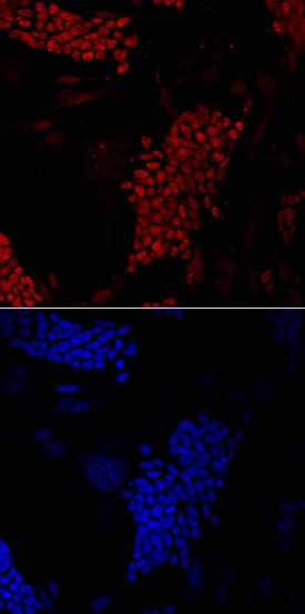 FoxD3 was detected in immersion fixed D3 mouse embryonic stem cells grown on iMEF using Goat Anti-Mouse FoxD3 Antigen Affinity-purified Polyclonal Antibody (Catalog # AF5090) at 10 µg/mL for 3 hours at room temperature. Cells were stained using the NorthernLights™ 557-conjugated Anti-Goat IgG Secondary Antibody (red, upper panel; Catalog # NL001) and counterstained with DAPI (blue, lower panel). Specific staining was localized to nuclei. View our protocol for Fluorescent ICC Staining of Cells on Coverslips.