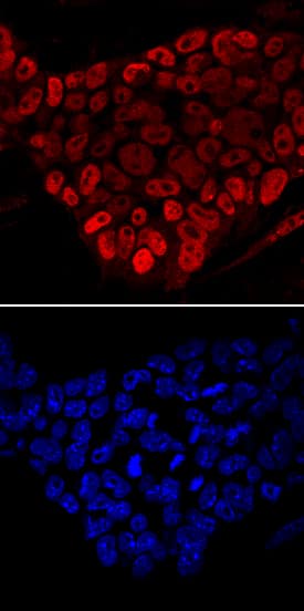 FoxD3 was detected in immersion fixed D3 mouse embryonic stem cell line using Rat Anti-Mouse FoxD3 Monoclonal Antibody (Catalog # MAB5090) at 10 µg/mL for 3 hours at room temperature. Cells were stained using the NorthernLights™ 557-conjugated Anti-Rat IgG Secondary Antibody (red, upper panel; Catalog # NL013) and counterstained with DAPI (blue, lower panel). Specific staining was localized to nuclei. View our protocol for Fluorescent ICC Staining of Cells on Coverslips.