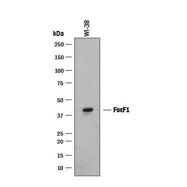 Western Blot FoxF1 Antibody [Unconjugated]