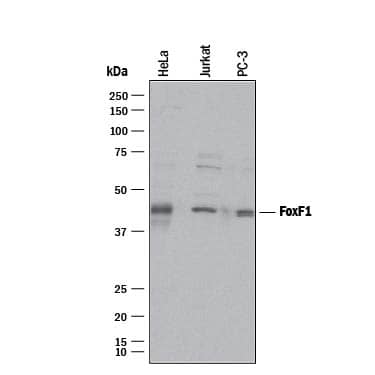 Western Blot FoxF1 Antibody [Unconjugated]