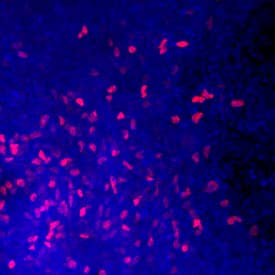 Immunocytochemistry FoxJ1/HFH4 Antibody [Unconjugated]