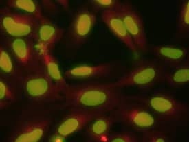 Immunocytochemistry FoxM1 Antibody