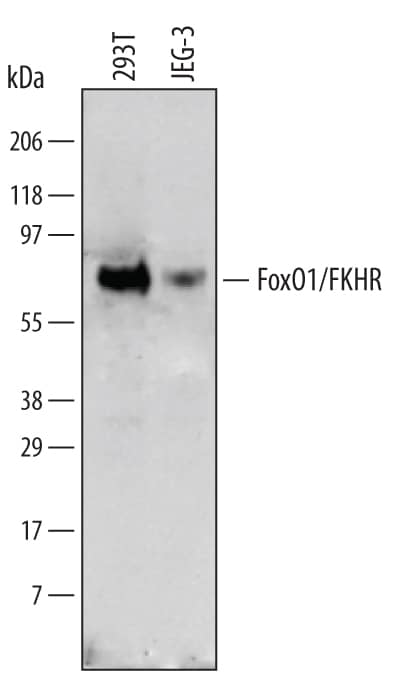 Western blot shows lysates of 293T human embryonic kidney cell line and JEG-3 human epithelial choriocarcinoma cell line. PVDF membrane was probed with 1 µg/mL of Human FoxO1/FKHR Antigen Affinity-purified Polyclonal Antibody (Catalog # AF5939) followed by HRP-conjugated Anti-Sheep IgG Secondary Antibody (Catalog # HAF016). A specific band was detected for FoxO1/FKHR at approximately 70 kDa (as indicated). This experiment was conducted under reducing conditions and using Immunoblot Buffer Group 1.
