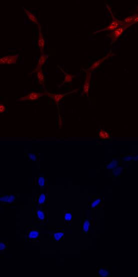 FoxO1/FKHR was detected in immersion fixed LNCaP human prostate cancer cell line using Human FoxO1/FKHR Monoclonal Antibody (Catalog # MAB5939) at 10 µg/mL for 3 hours at room temperature. Cells were stained using the NorthernLights™ 557-conjugated Anti-Mouse IgG Secondary Antibody (red, upper panel; NL007) and counterstained with DAPI (blue, lower panel). Specific staining was localized to nuclei. View our protocol for Fluorescent ICC Staining of Cells on Coverslips.