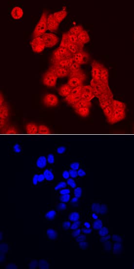 FoxO3 was detected in immersion fixed MCF-7 human breast cancer cell line using Sheep Anti-Human FoxO3 Antigen Affinity-purified Polyclonal Antibody (Catalog # AF6165) at 10 µg/mL for 3 hours at room temperature. Cells were stained using the NorthernLights™ 557-conjugated Anti-Sheep IgG Secondary Antibody (red, upper panel; Catalog # NL010) and counterstained with DAPI (blue, lower panel). Specific staining was localized to nuclei and cytoplasm. View our protocol for Fluorescent ICC Staining of Cells on Coverslips.