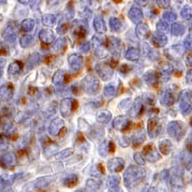 FoxP3 was detected in immersion fixed paraffin-embedded sections of human tonsil using 10 µg/mL Goat Anti-Human FoxP3 Antigen Affinity-purified Polyclonal Antibody (Catalog # AF3240) overnight at 4 °C. Tissue was stained with the Anti-Goat HRP-DAB Cell & Tissue Staining Kit (brown; Catalog # CTS008) and counterstained with hematoxylin (blue). View our protocol for Chromogenic IHC Staining of Paraffin-embedded Tissue Sections.