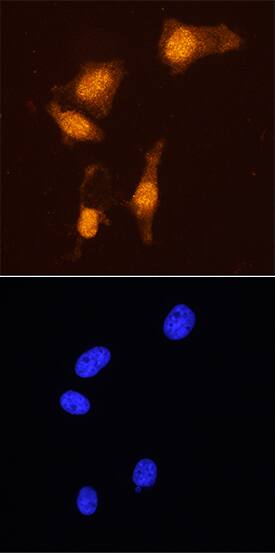 Immunocytochemistry FoxP3 Antibody (1054C) [Unconjugated]
