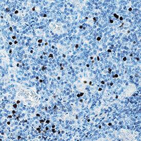 Immunohistochemistry FoxP3 Antibody (1054C) [Unconjugated]