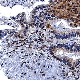 Immunohistochemistry FoxP3 Antibody (1054C) [Unconjugated]