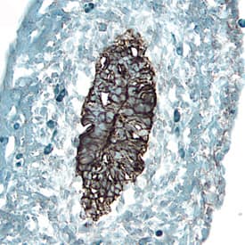 Immunohistochemistry Frizzled-1 Antibody