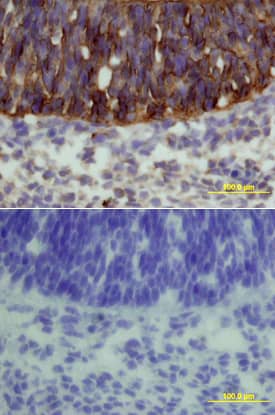 Immunohistochemistry Frizzled-3 Antibody [Unconjugated]