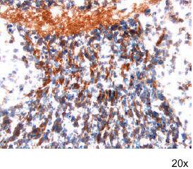 Immunohistochemistry Frizzled-4 Antibody